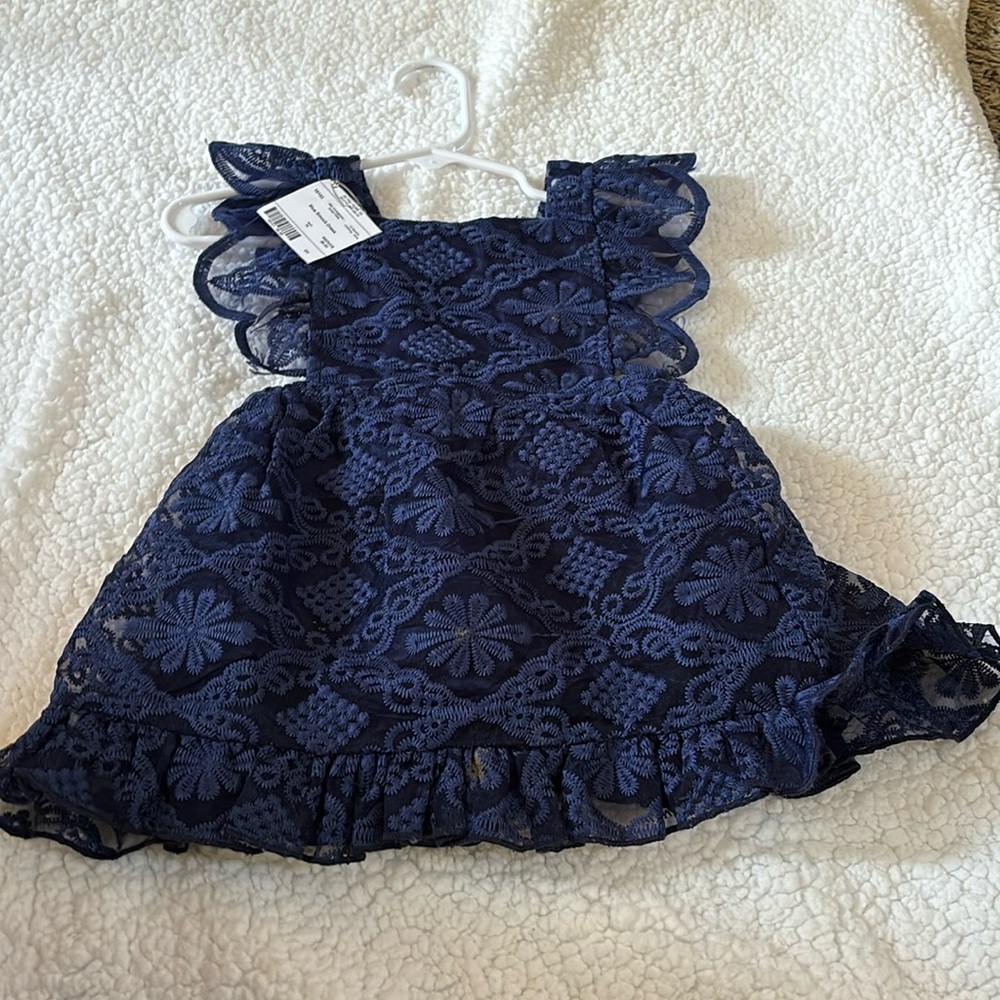 Blue Lace Dress